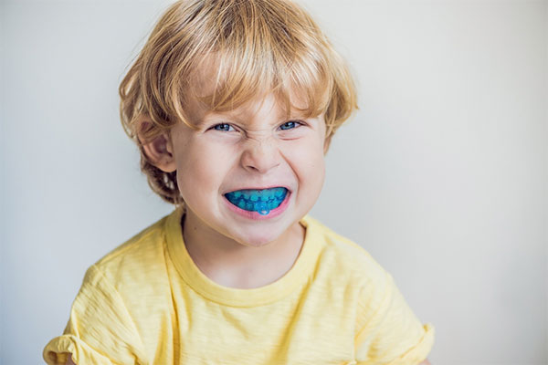 Myobrace Your Child's Teeth