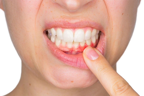 Offering gum disease treatment at our dental clinic